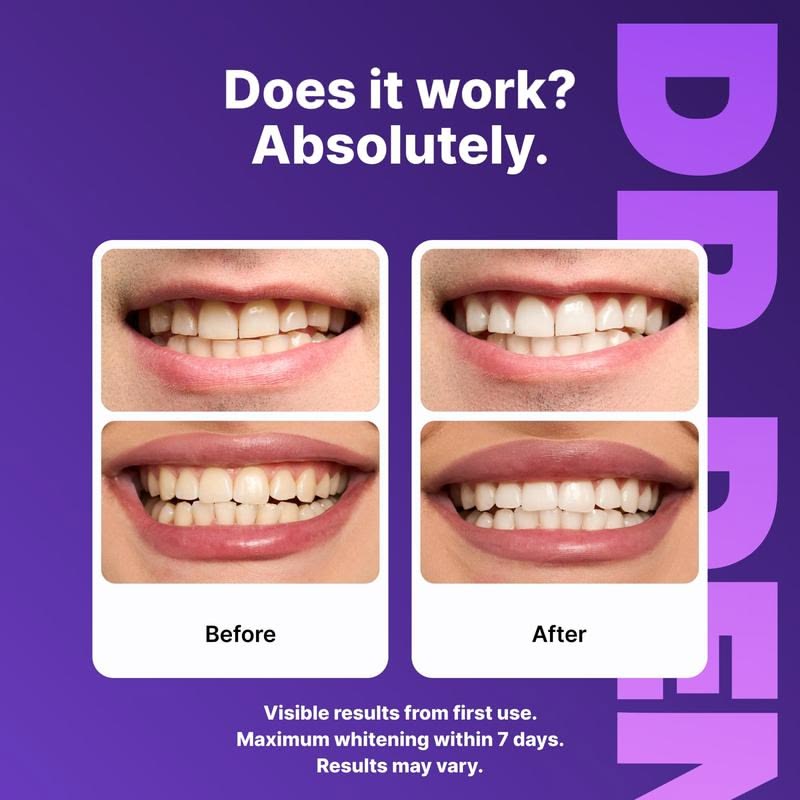 SparkSmileā¢ļø Gentle Purple Teeth Strips