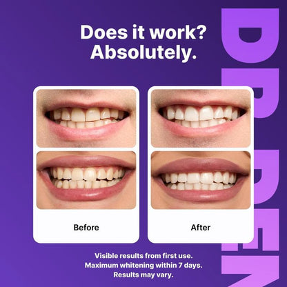 SparkSmile™️ Gentle Purple Teeth Strips
